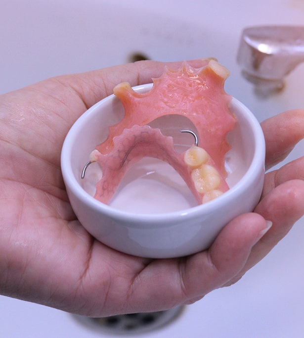 Partial Dentures